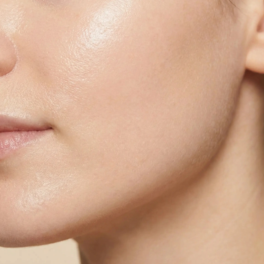 Facial contour improvement