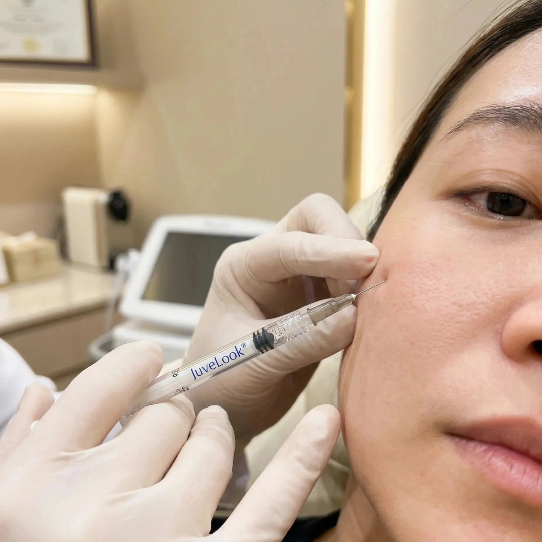 Skin booster support with Juvelook