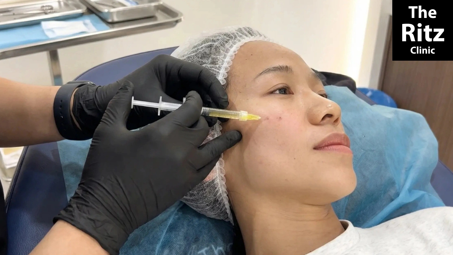 PRP skin rejuvenation treatment in Johor Bahru