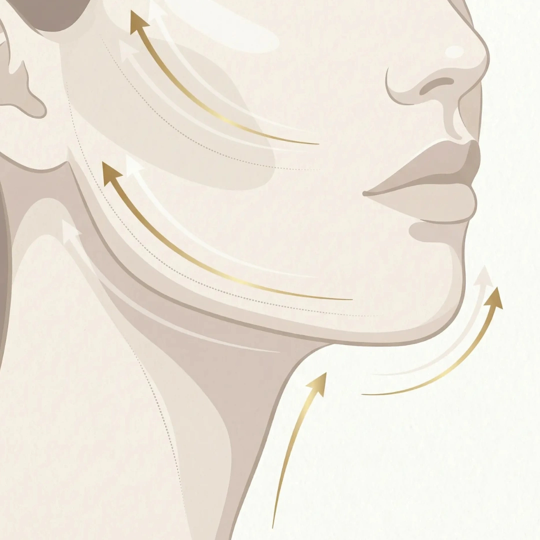 Doctor-led Sculptra treatment at The Ritz Clinic