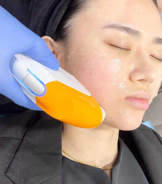 HIFU treatment