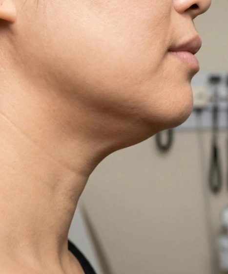 Double chin and jawline assessment at The Ritz Clinic in Johor Bahru Malaysia