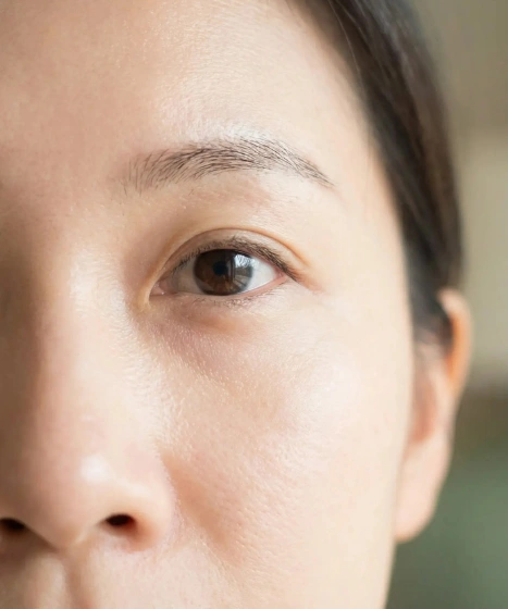 Doctor consultation for eye bags and dark eye circles at The Ritz Clinic Malaysia