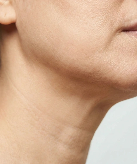 Saggy skin assessment and lifting consultation at The Ritz Clinic in Johor Bahru Malaysia