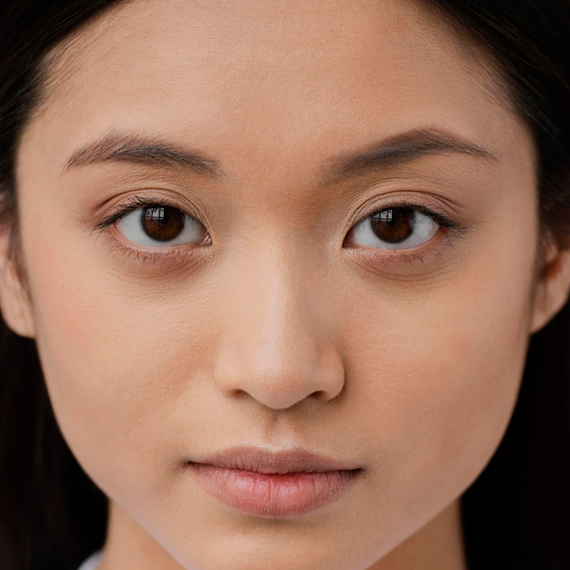 Dark eye circles concern