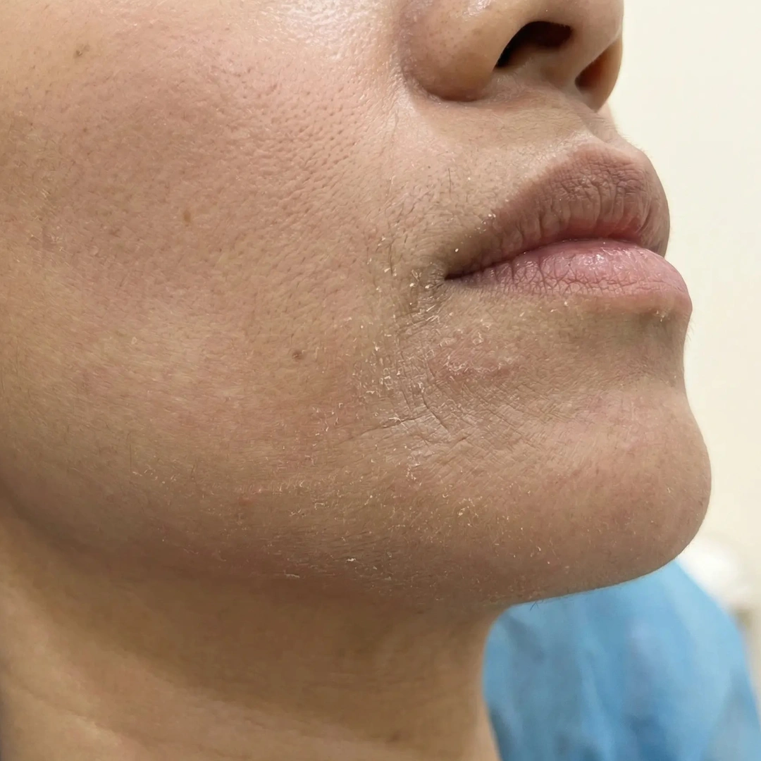 Dry skin concern