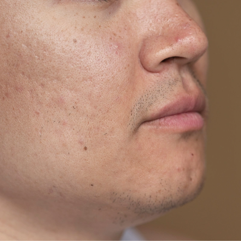 Facial contour concern