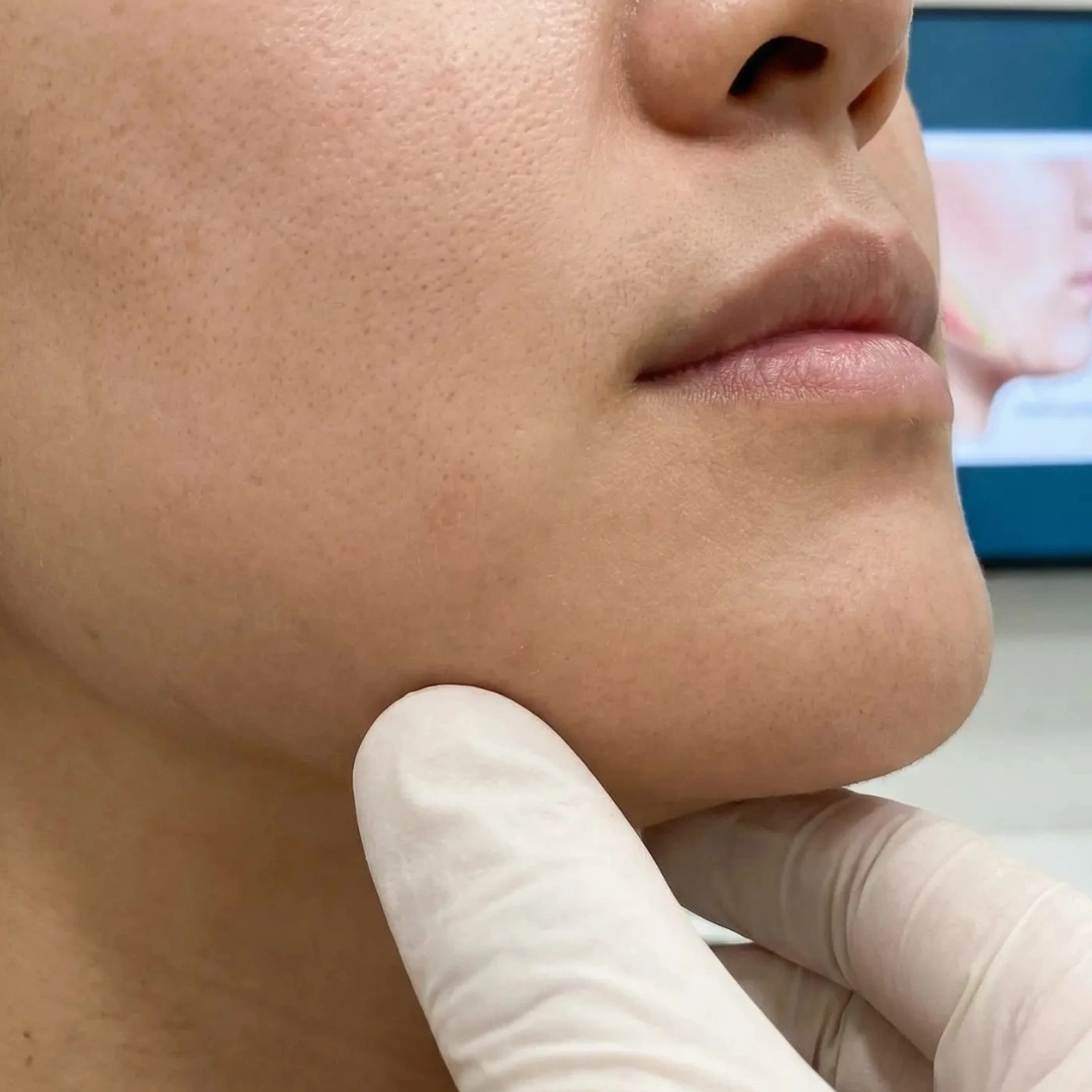 Jawline definition concern