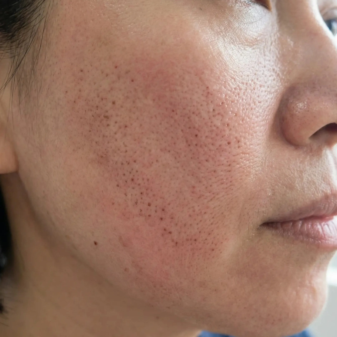 Skin Quality Concern