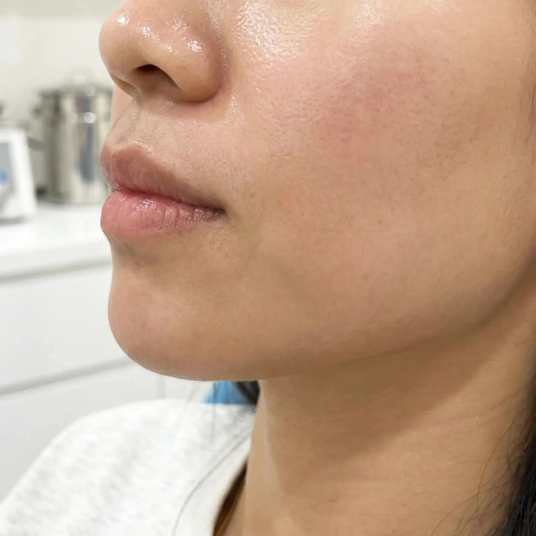 Skin repair concern