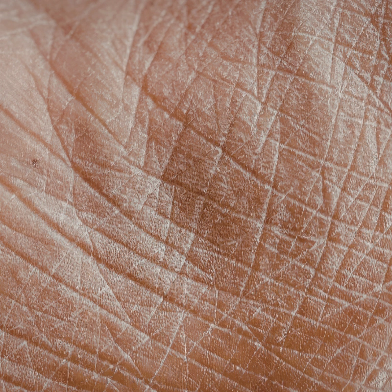 Texture concern
