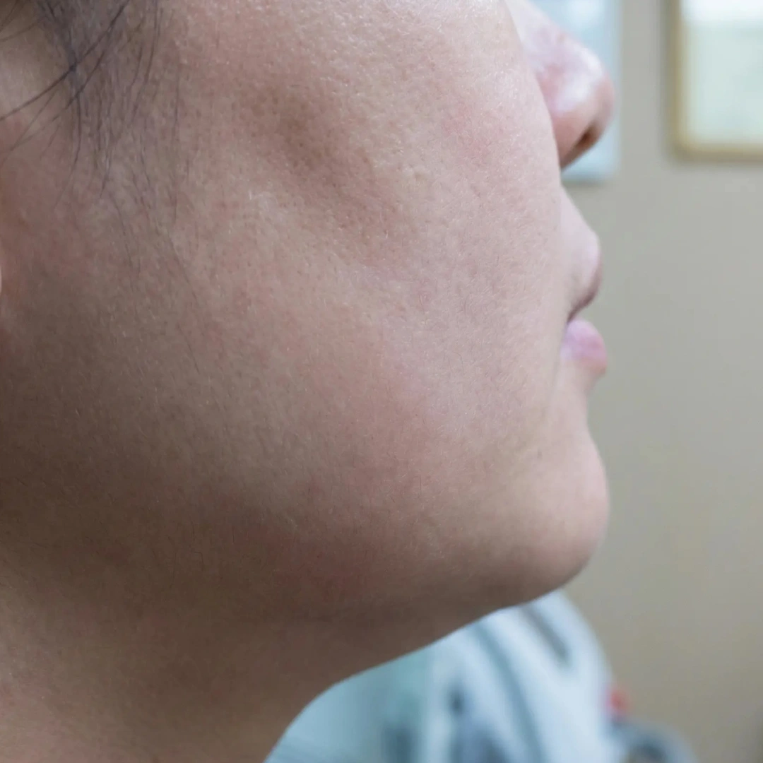 Facial Contours Skin Concern