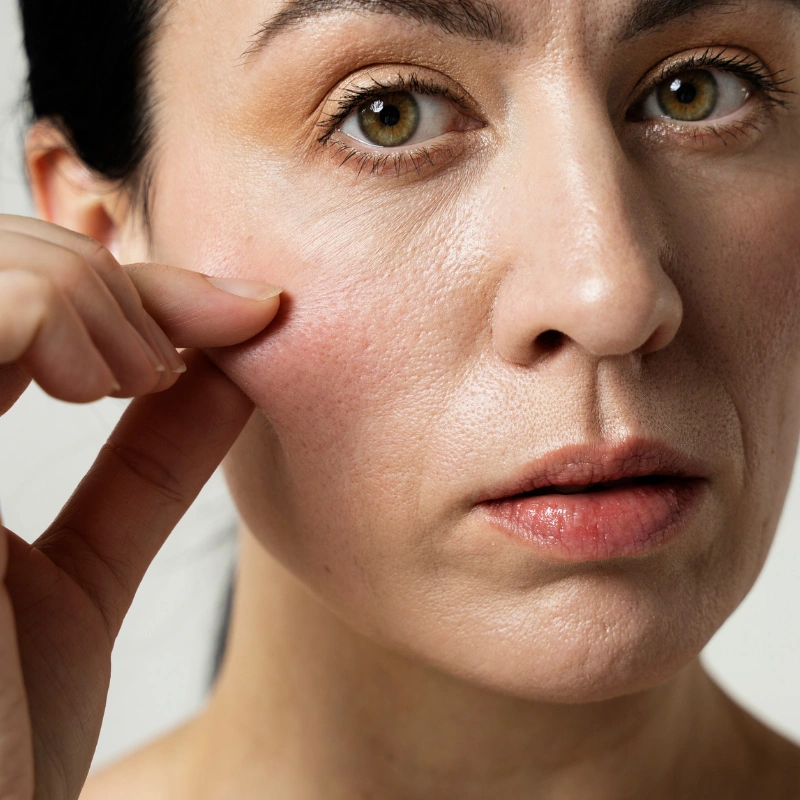 Ageing skin concern