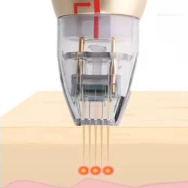 Dual-wave precision with Sylfirm X