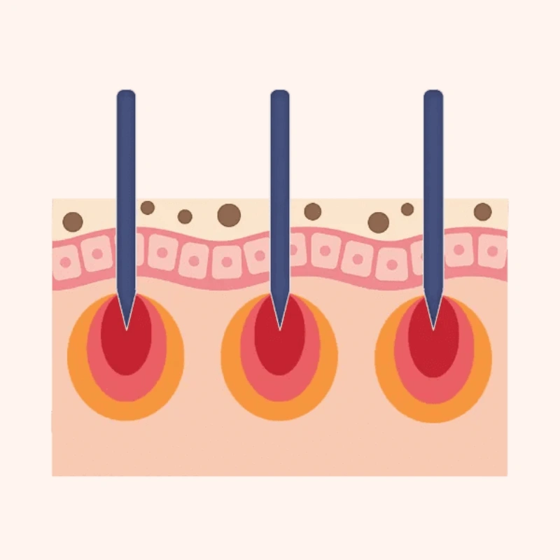 Targeted concern treatment with Sylfirm X