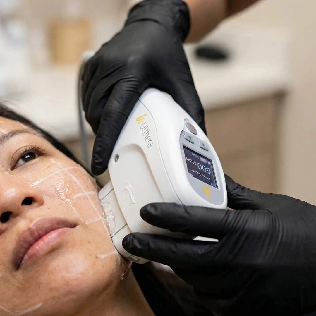 Gradual, natural lift