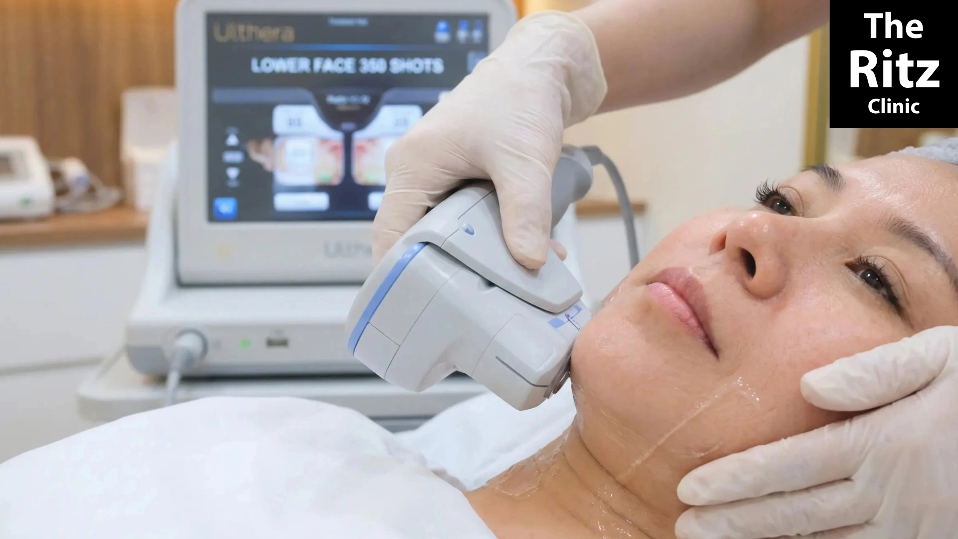 Ultherapy Prime treatment in Johor Bahru